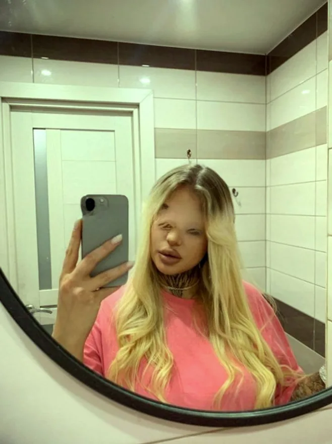Nika